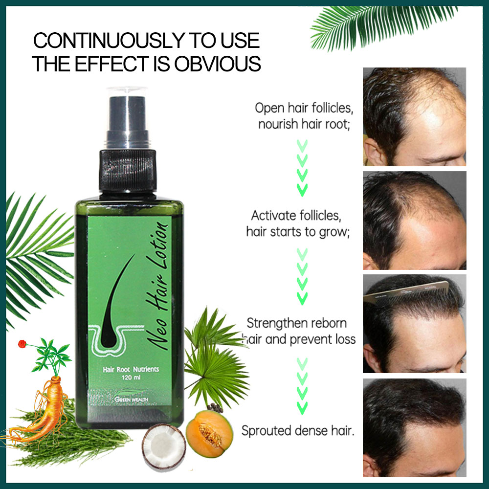 4 pcs Neo Hair Lotion 120ml Ha - Nutrition And Fitness review and price